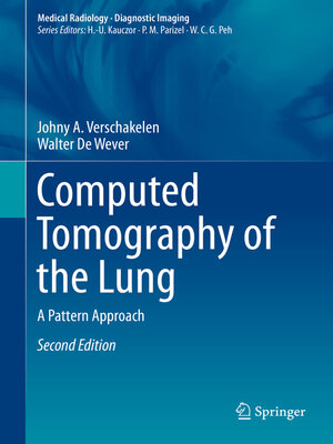 cover image of Computed Tomography of the Lung
